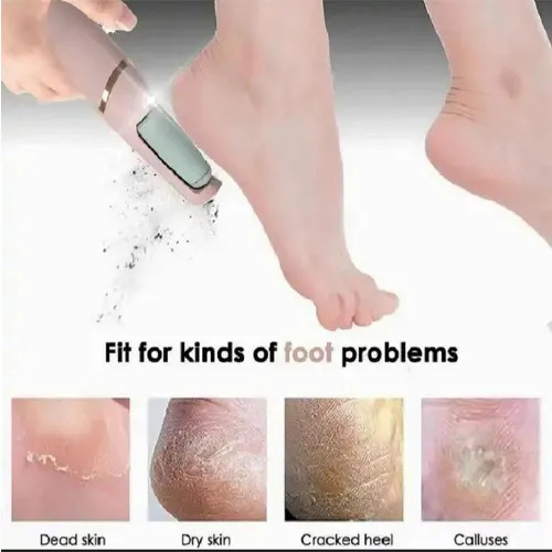 سوهان پا (سنگ پا) برقی شارژی